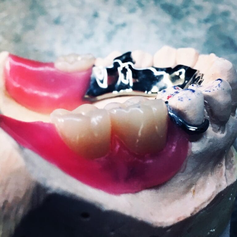 teeth bow valley denture implan centre canmore 768x768